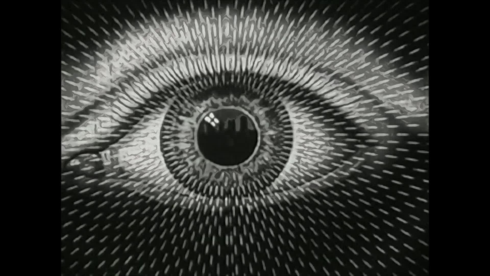 Vision